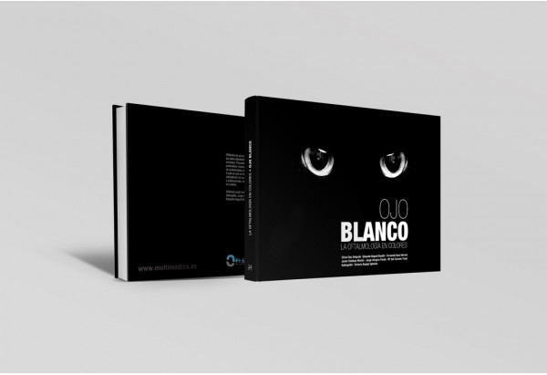 Ojo blanco. La oftalmología en colores -Manuales prácticos