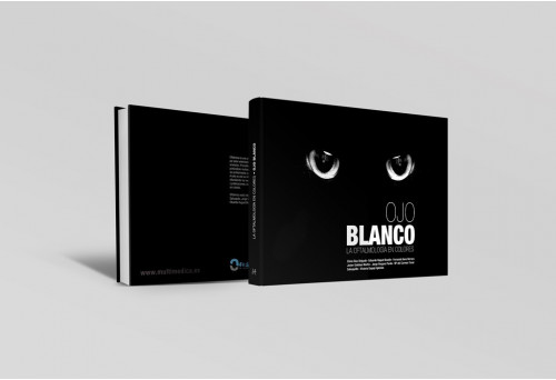Ojo blanco. La oftalmologí­a en colores -Manuales prácticos
