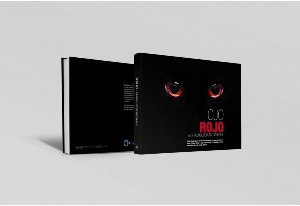 Ojo rojo. La oftalmología en colores -Manuales prácticos