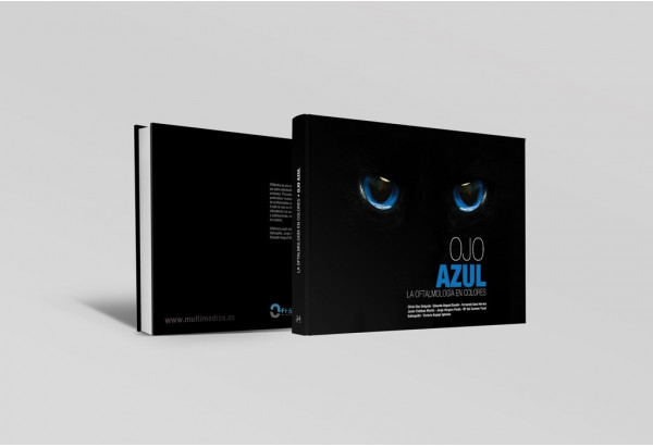 Ojo azul. La oftalmología en colores -Manuales prácticos