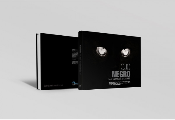 Ojo negro. La oftalmología en colores -Manuales prácticos